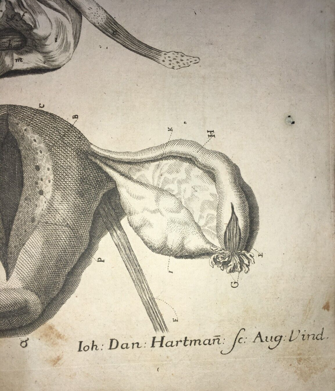 Medicina: Anatomia Umana E Ginecologia. Antica Incisione Di I.D. Hartman, XVIII Secolo.