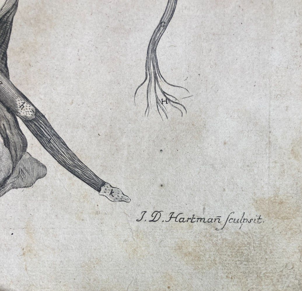 Medicina: Anatomia Umana, Ginecologia, Utero E Ovaie. Incisione Di Hartman, XVIII Secolo