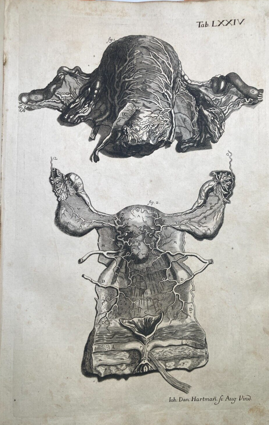 Medicina: Anatomia Umana, Angiologia E Ginecologia (Utero E Ovaie)   Incisore Hartman, XVIII Secolo