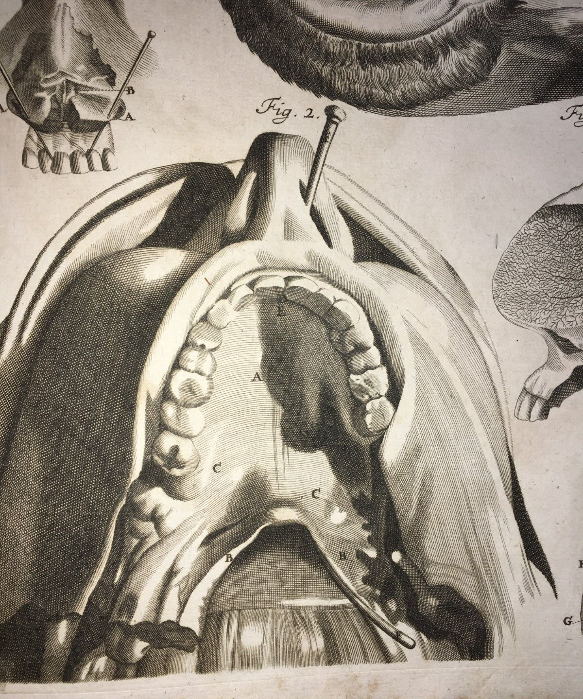 Medicina, Anatomia: Apparato Della Bocca, Lingua, Denti, Naso. Rara Incisione Di Seiller