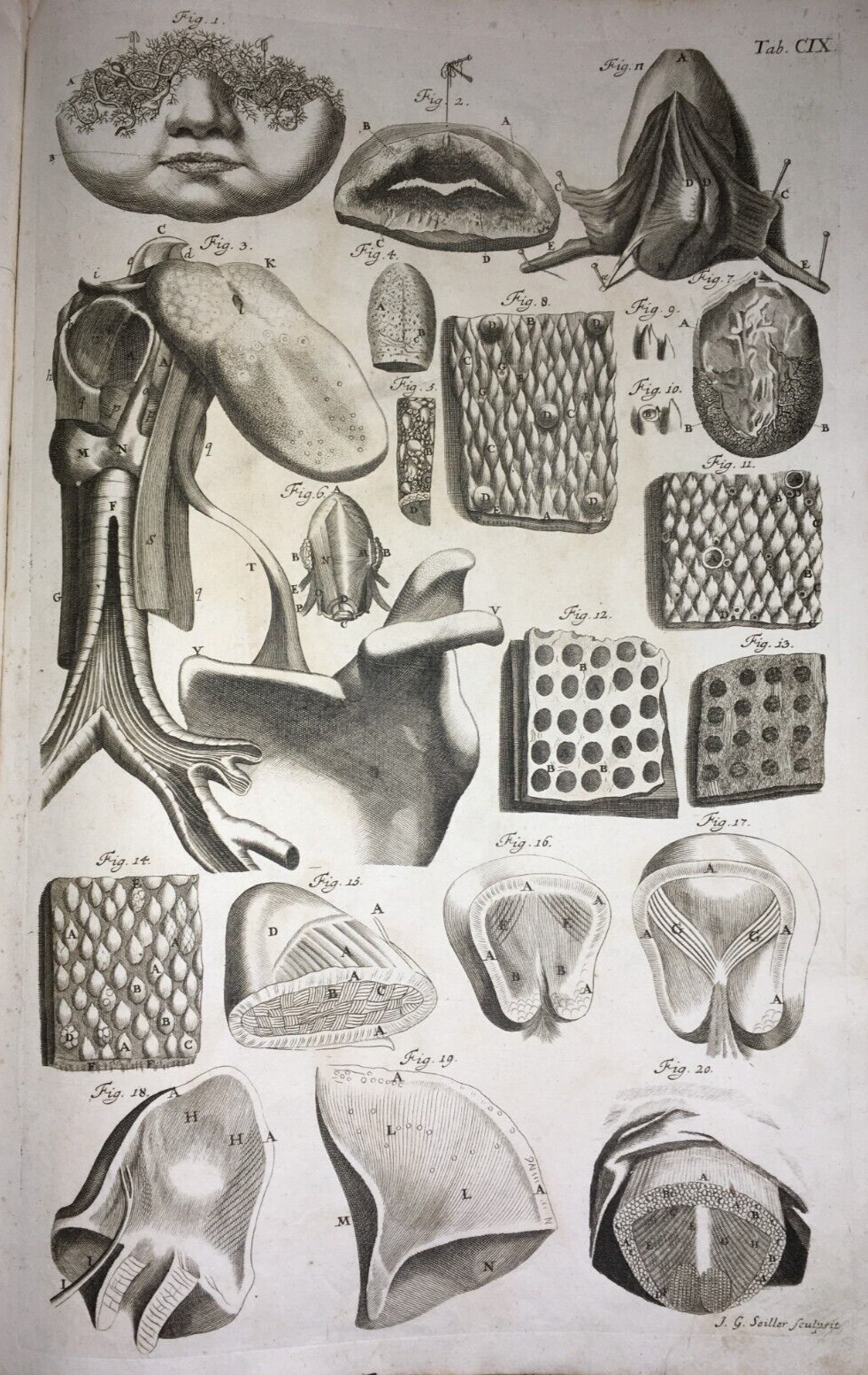 Medicina, Anatomia: Apparato Della Bocca, Lingua E Trachea. Rara Incisione Di Johann Georg Seiller