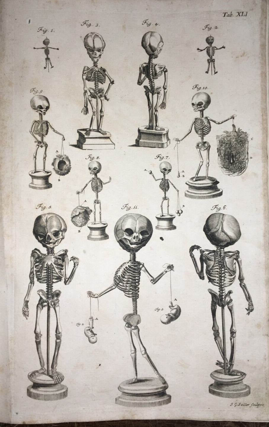 Medicina, Anatomia E Osteologia: Scheletri Umani. Incisione Di Johann Georg Seiller
