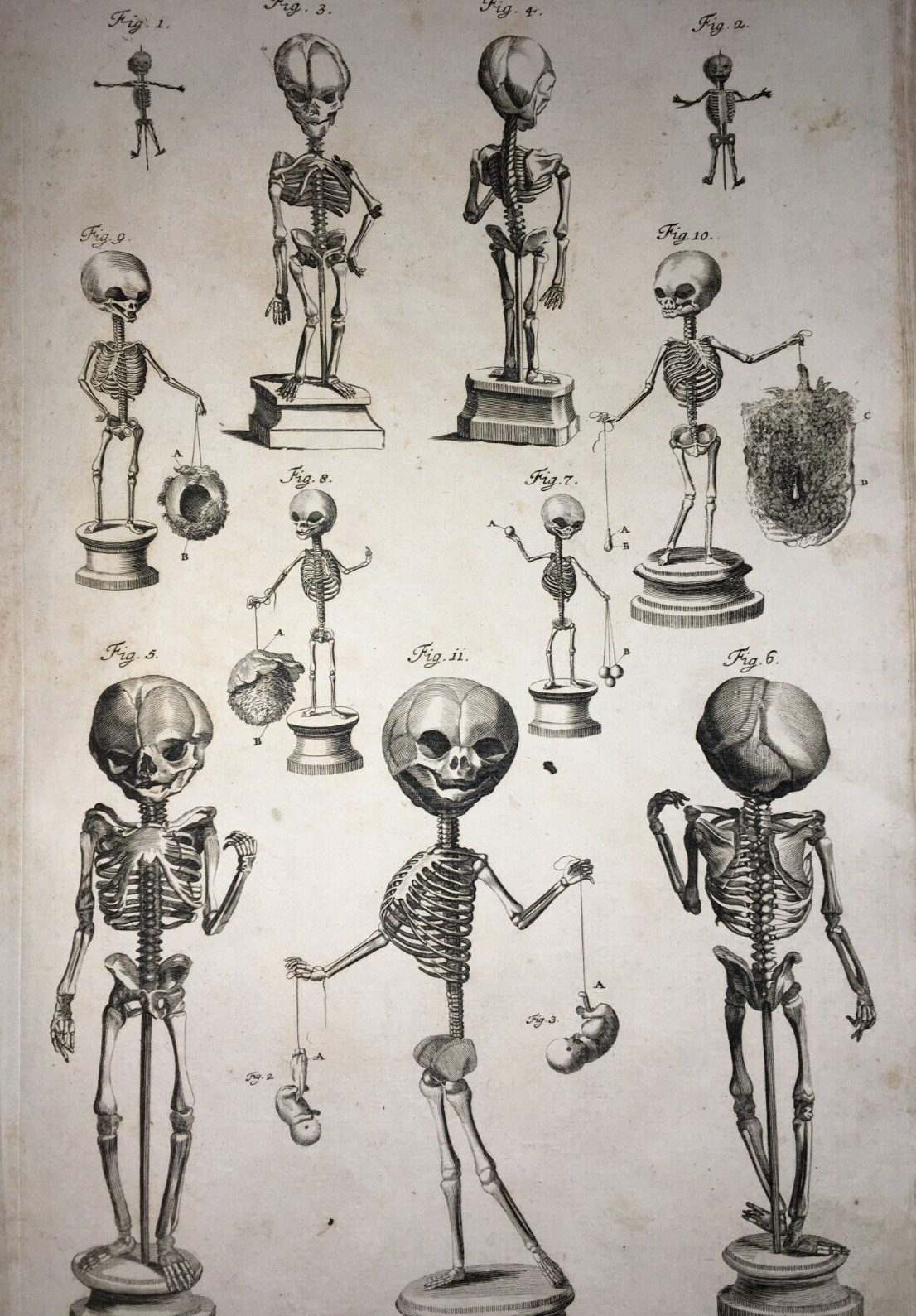 Medicina, Anatomia E Osteologia: Scheletri Umani. Incisione Di Johann Georg Seiller