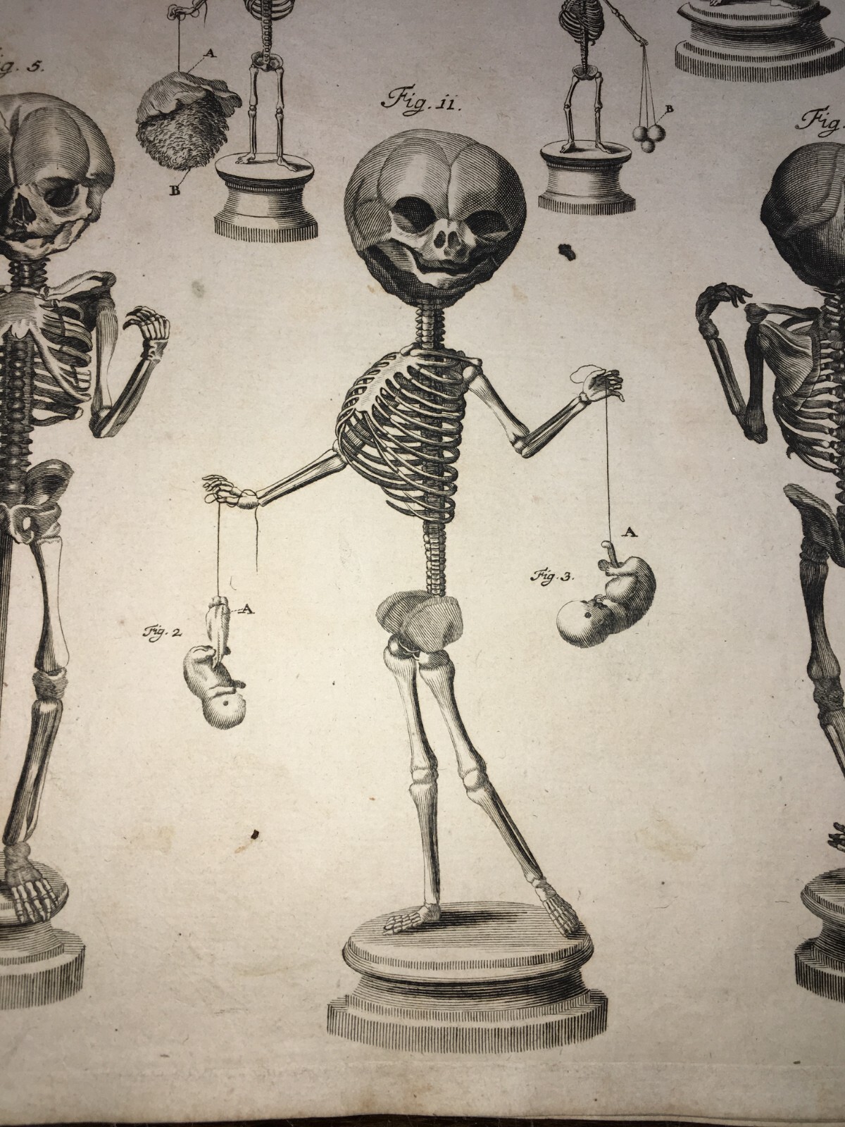 Medicina, Anatomia E Osteologia: Scheletri Umani. Incisione Di Johann Georg Seiller