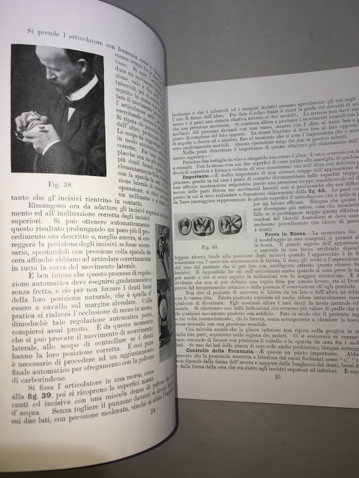 Montaggio Di Apparecchi Con Denti Anatoform E Blocchi Gysi. Metodo Del Dr. Gysi (Anni '30)