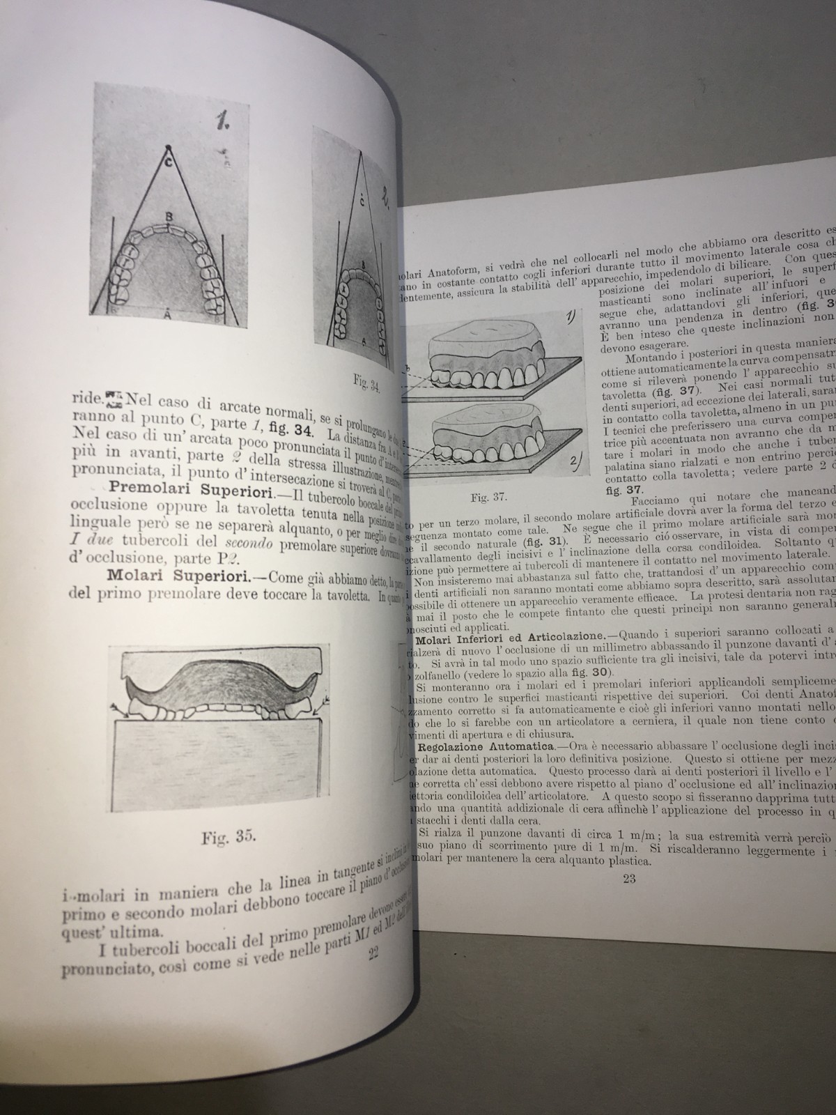 Montaggio Di Apparecchi Con Denti Anatoform E Blocchi Gysi. Metodo Del Dr. Gysi (Anni '30)