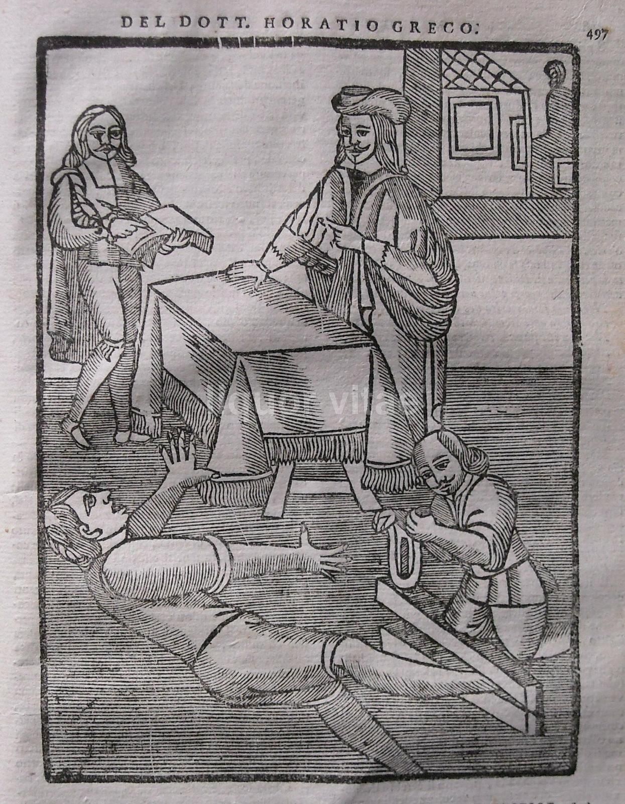 Novissima Praxis Civilis Et Criminalis Napoli 1717 Medicina Legale