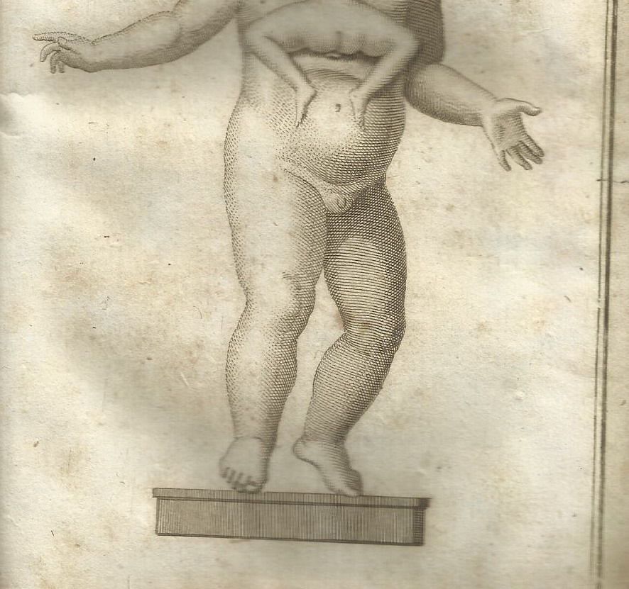 Bambino Mostruoso Nola 1805 De Luca Anatomia Patologia Rara