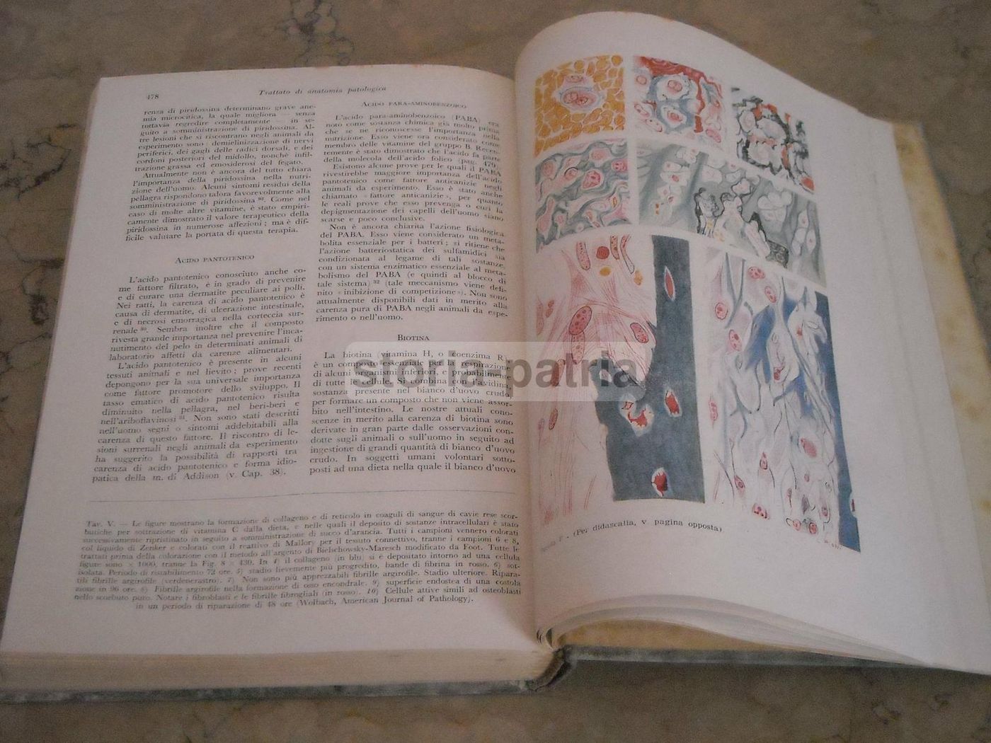 Trattato Di Anatomia Patologica Anderson 3 Volumi SEU 1956