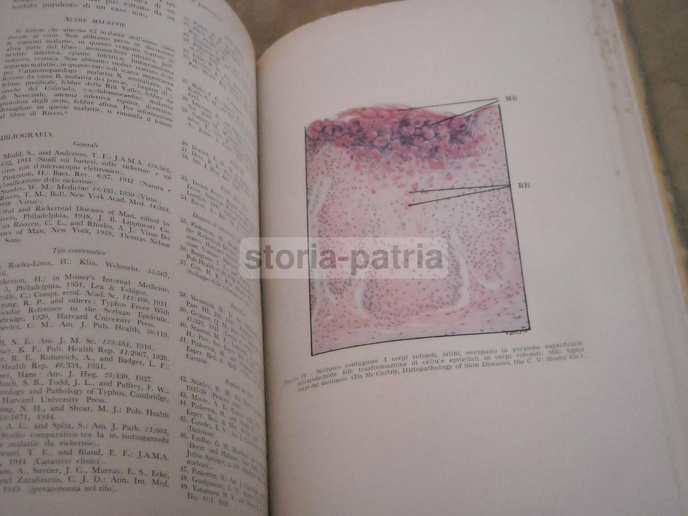 Trattato Di Anatomia Patologica Anderson 3 Volumi SEU 1956