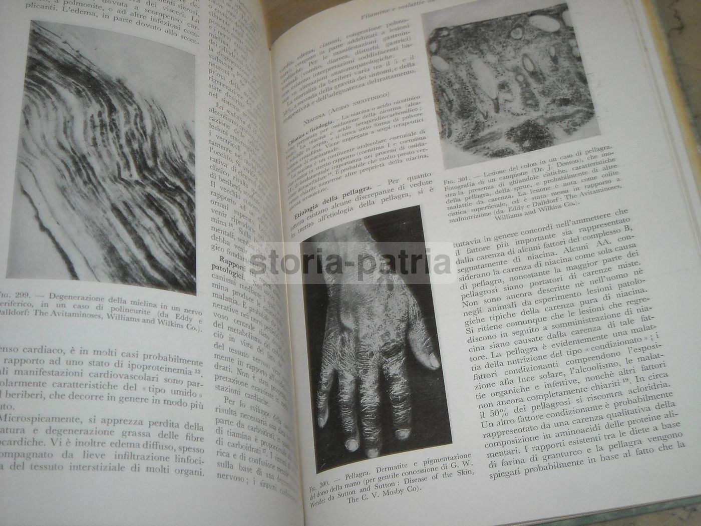 Trattato Di Anatomia Patologica Anderson 3 Volumi SEU 1956