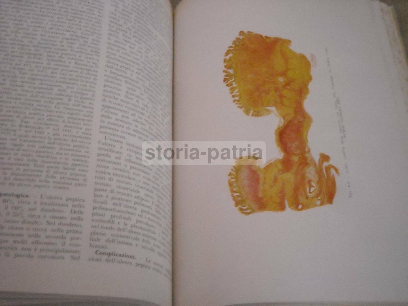Trattato Di Anatomia Patologica Anderson 3 Volumi SEU 1956