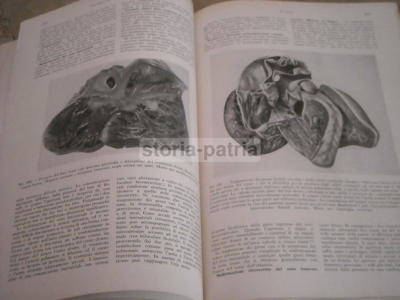 Trattato Di Anatomia Patologica Anderson 3 Volumi SEU 1956