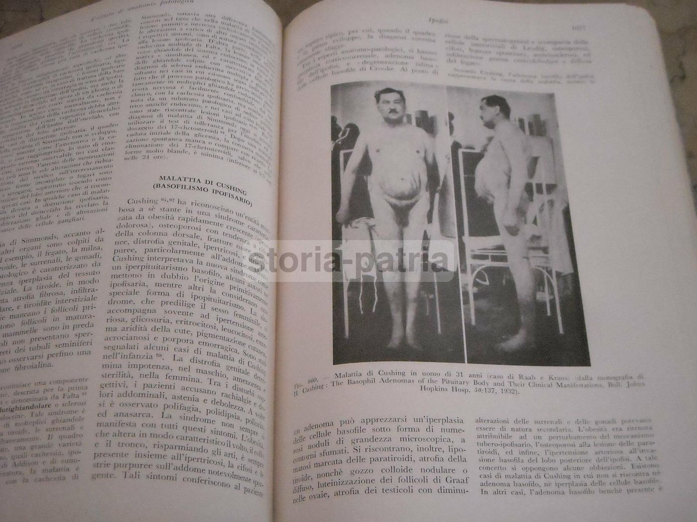 Trattato Di Anatomia Patologica Anderson 3 Volumi SEU 1956