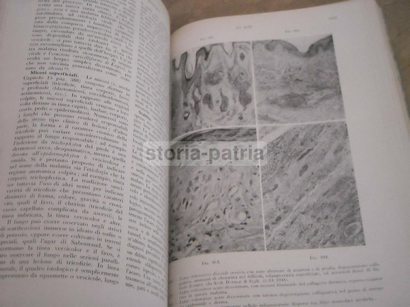 Trattato Di Anatomia Patologica Anderson 3 Volumi SEU 1956