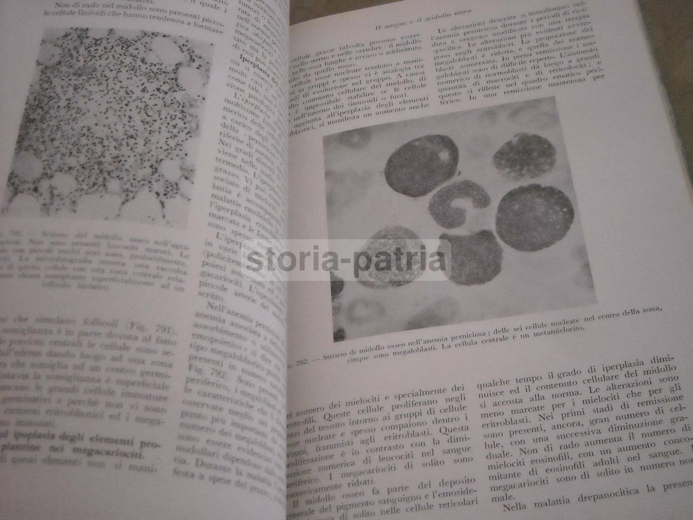 Trattato Di Anatomia Patologica Anderson 3 Volumi SEU 1956