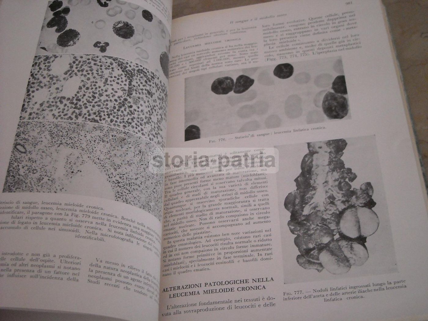 Trattato Di Anatomia Patologica Anderson 3 Volumi SEU 1956