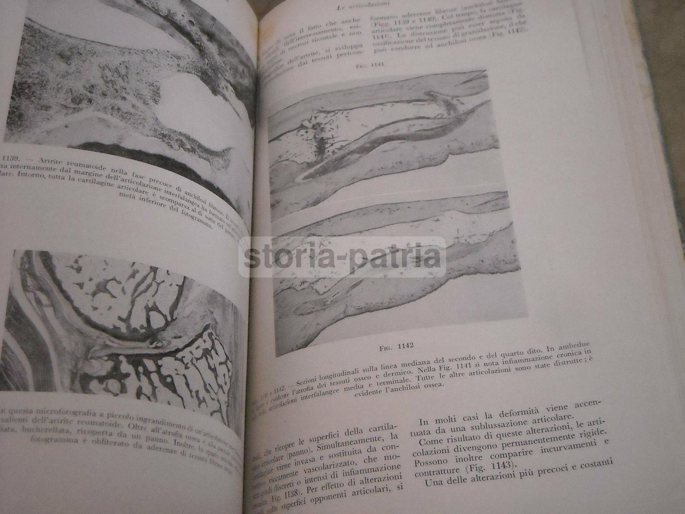Trattato Di Anatomia Patologica Anderson 3 Volumi SEU 1956