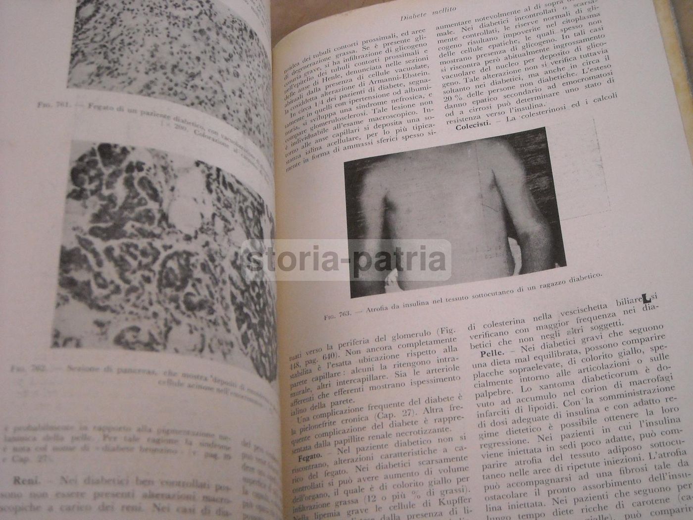 Trattato Di Anatomia Patologica Anderson 3 Volumi SEU 1956
