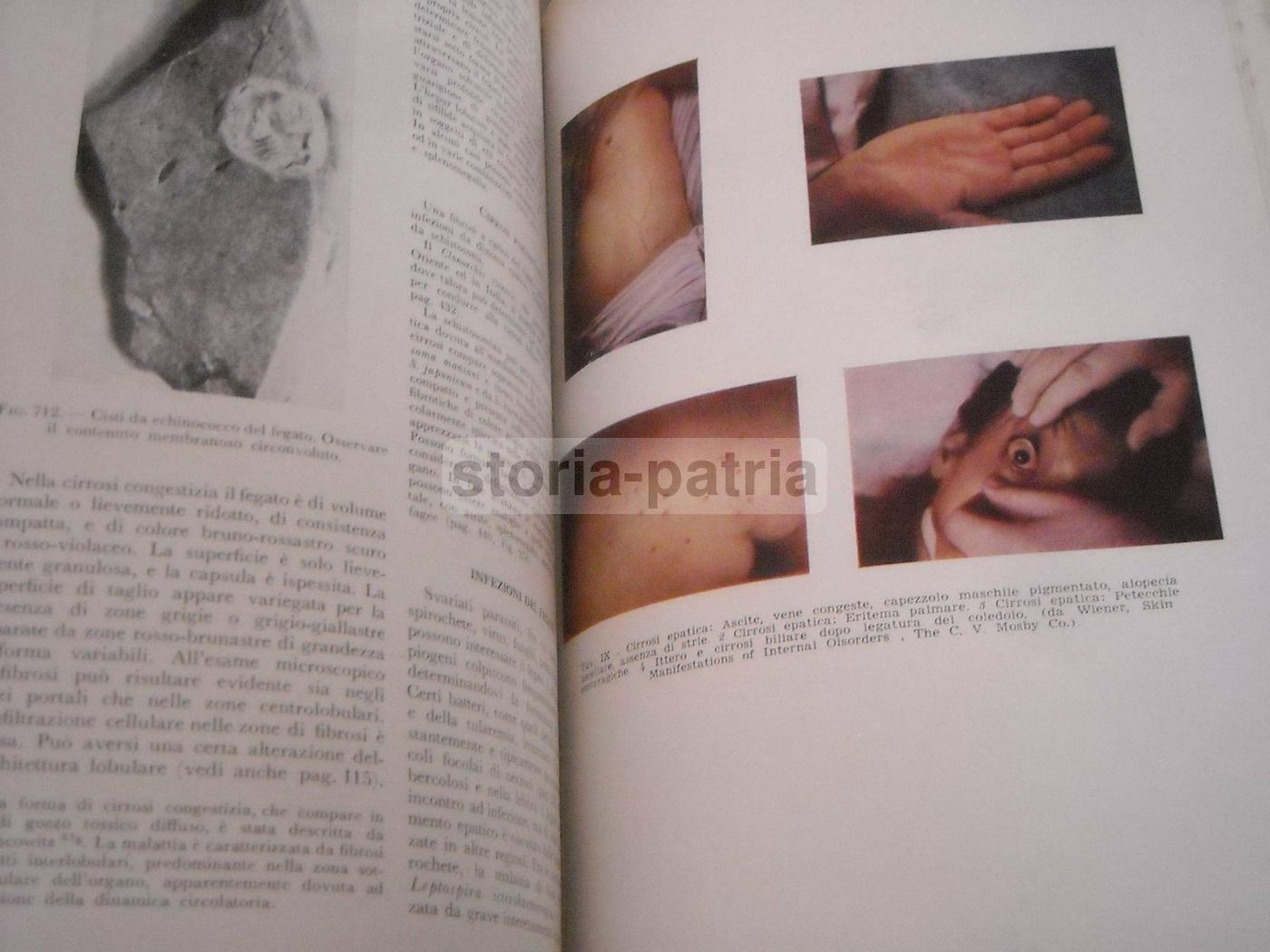 Trattato Di Anatomia Patologica Anderson 3 Volumi SEU 1956