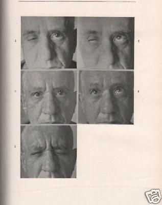 Bollettino d'Oculistica 1957: Medicina, Chirurgia E Patologia Dell'Occhio