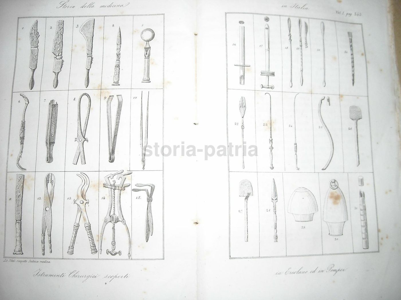 Strumenti Chirurgici Antichi Di Pompei Ed Ercolano, Stampa Litografica Del 1850