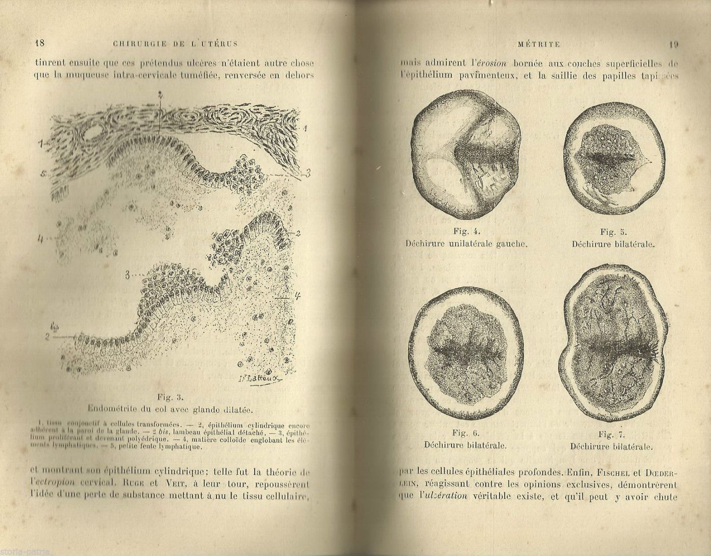 Chirurgie De L'Utérus Richelot 1902 Ginecologia Chirurgia Antica