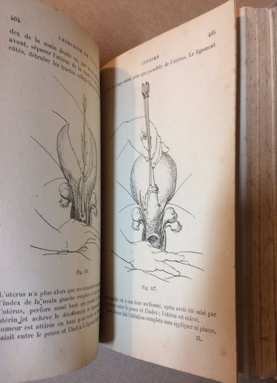 Chirurgie De L'Utérus Richelot 1902 Ginecologia Chirurgia Antica