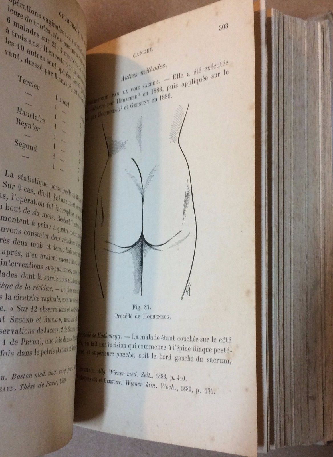 Chirurgie De L'Utérus Richelot 1902 Ginecologia Chirurgia Antica