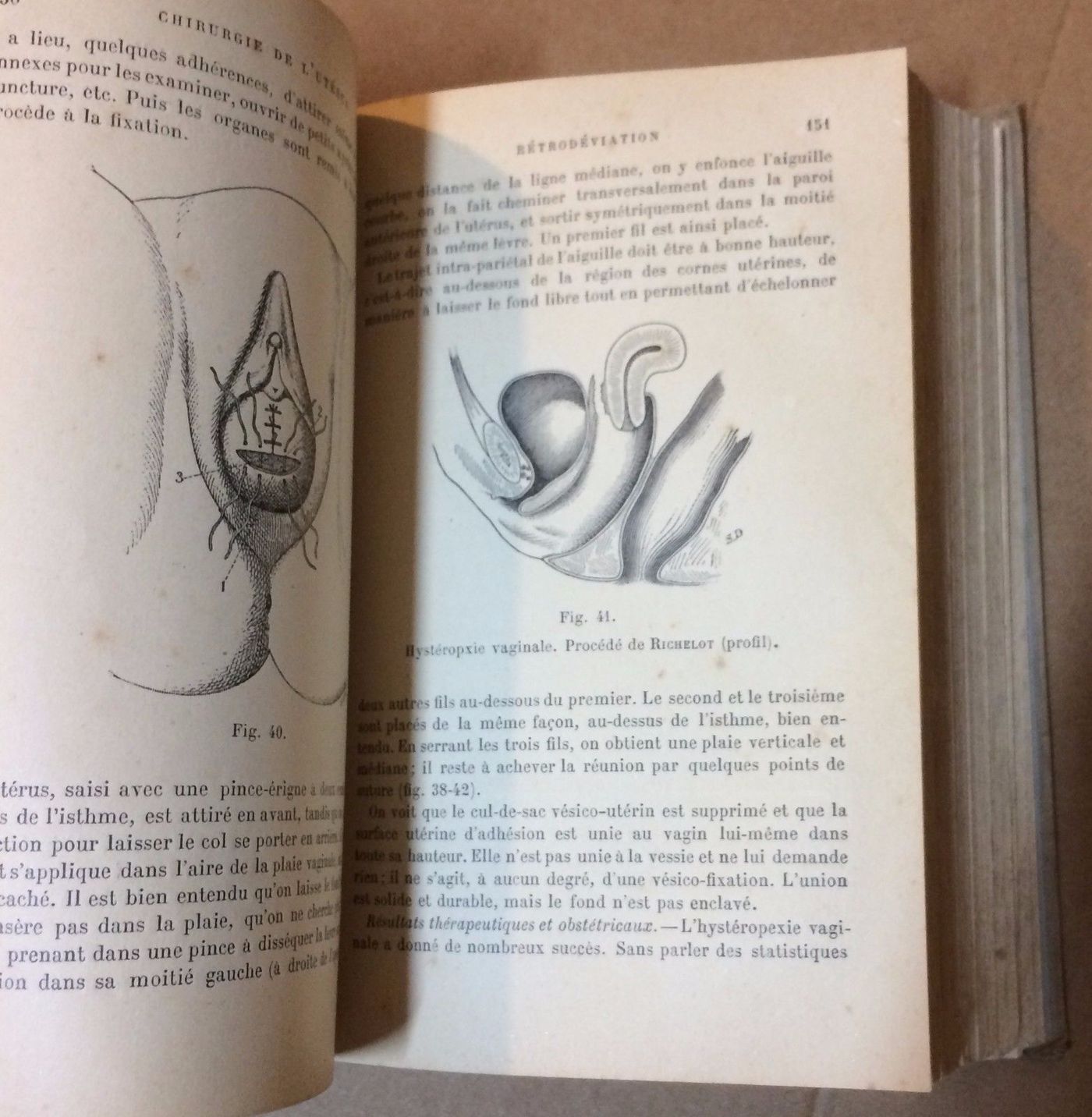 Chirurgie De L'Utérus Richelot 1902 Ginecologia Chirurgia Antica