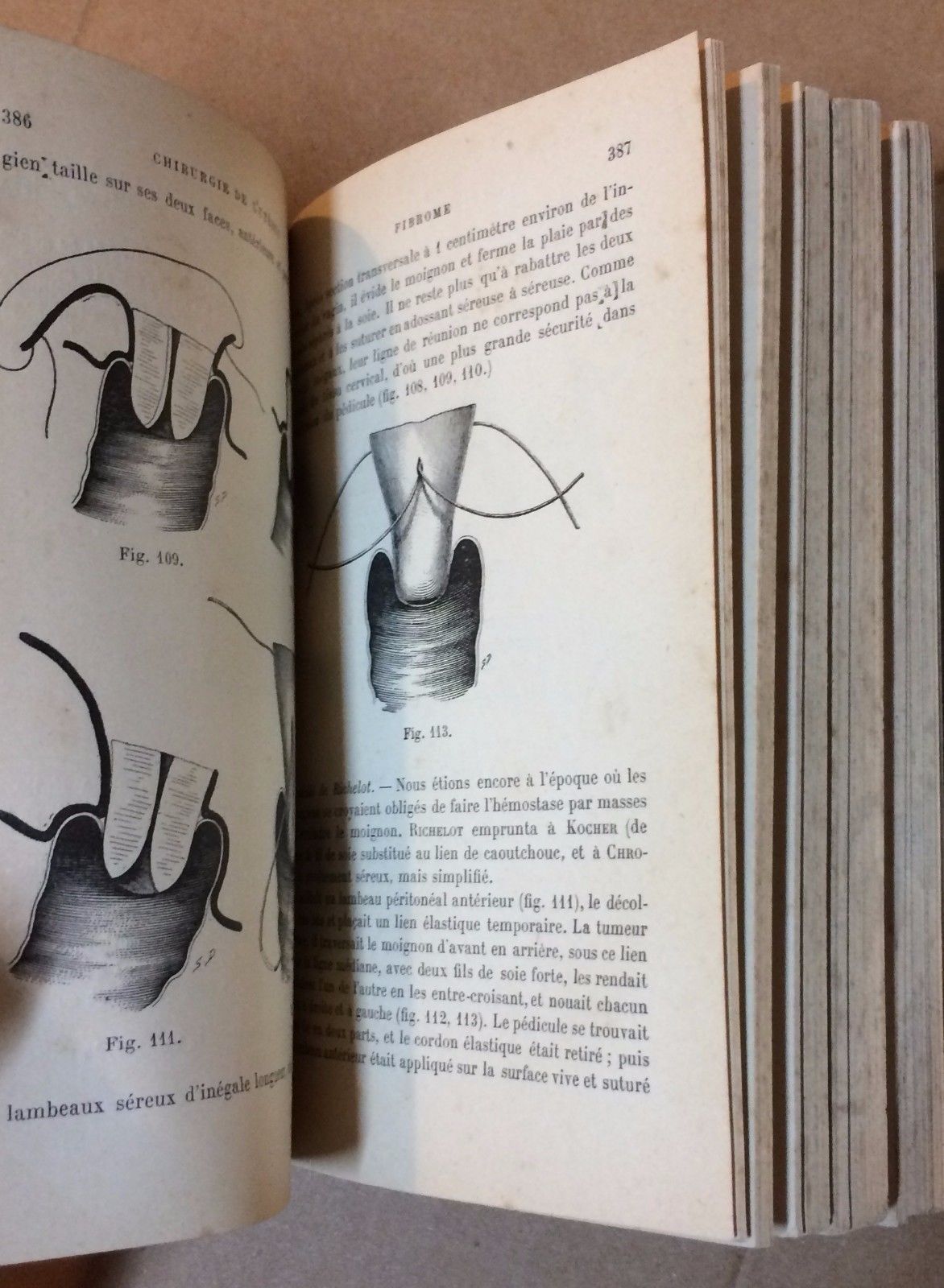Chirurgie De L'Utérus Richelot 1902 Ginecologia Chirurgia Antica