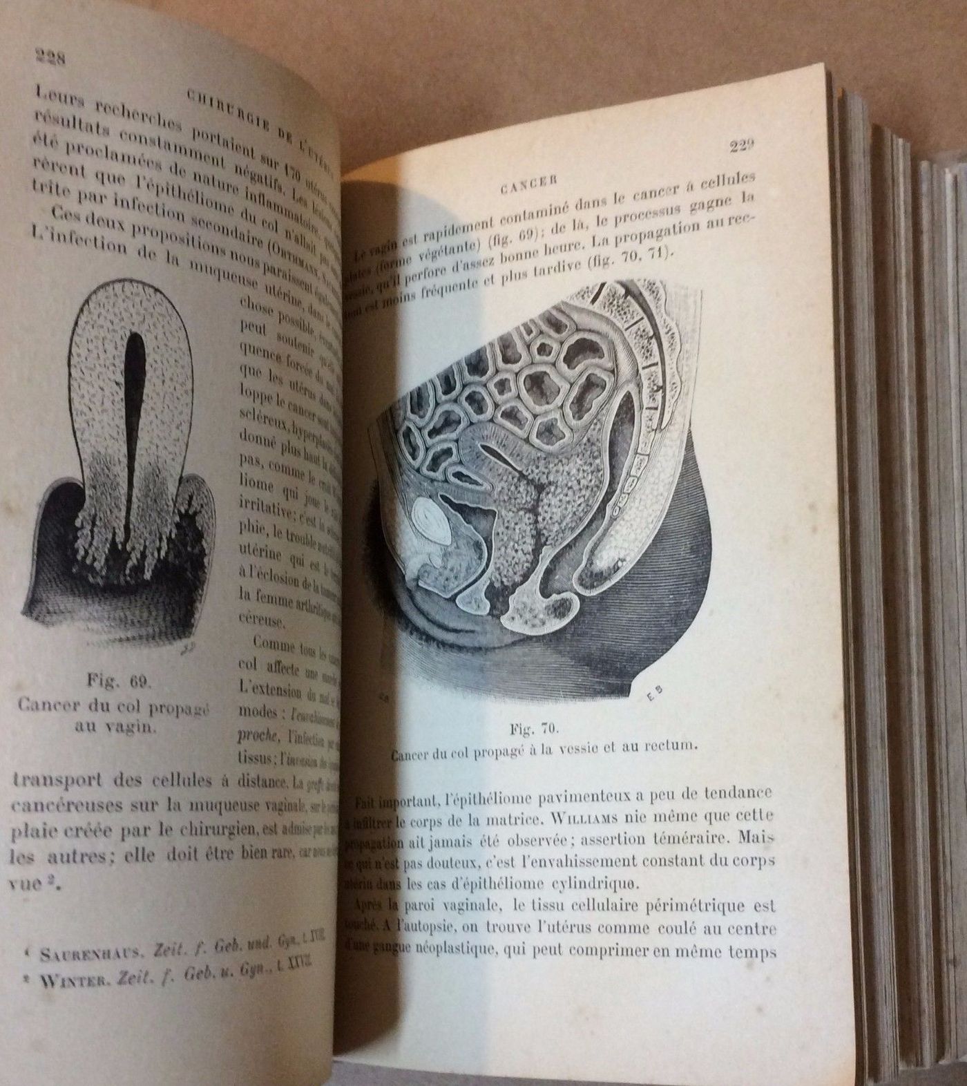 Chirurgie De L'Utérus Richelot 1902 Ginecologia Chirurgia Antica