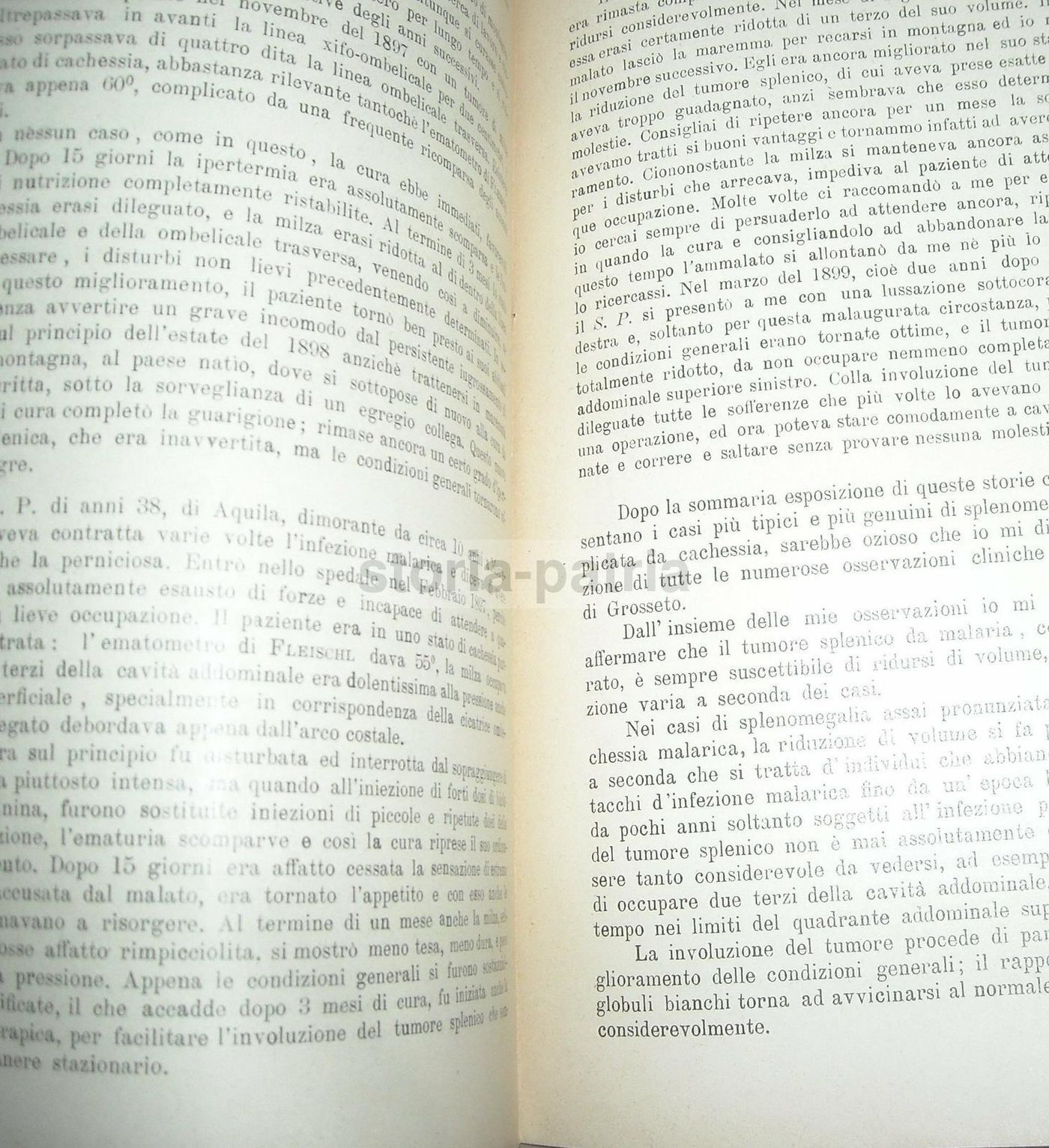 Nannotti, Studio Sulla Splenectomia Nella Splenomegalia Malarica (1900)