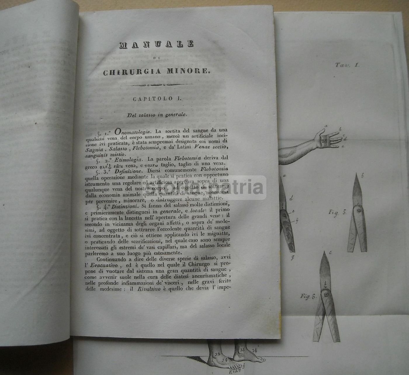 Manuale Di Chirurgia Minore, Monterossi, 1834, Napoli, Medicina Antica