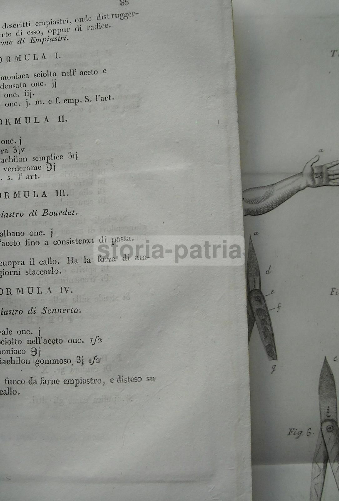 Manuale Di Chirurgia Minore, Monterossi, 1834, Napoli, Medicina Antica