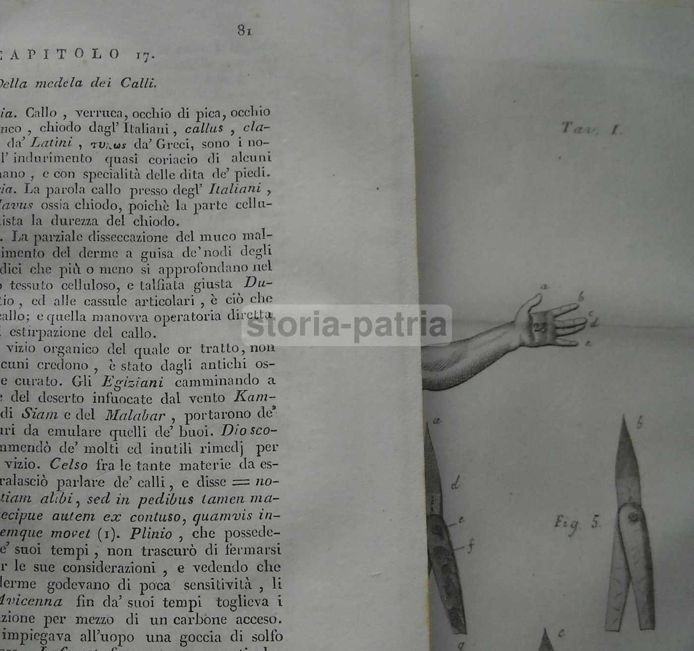 Manuale Di Chirurgia Minore, Monterossi, 1834, Napoli, Medicina Antica