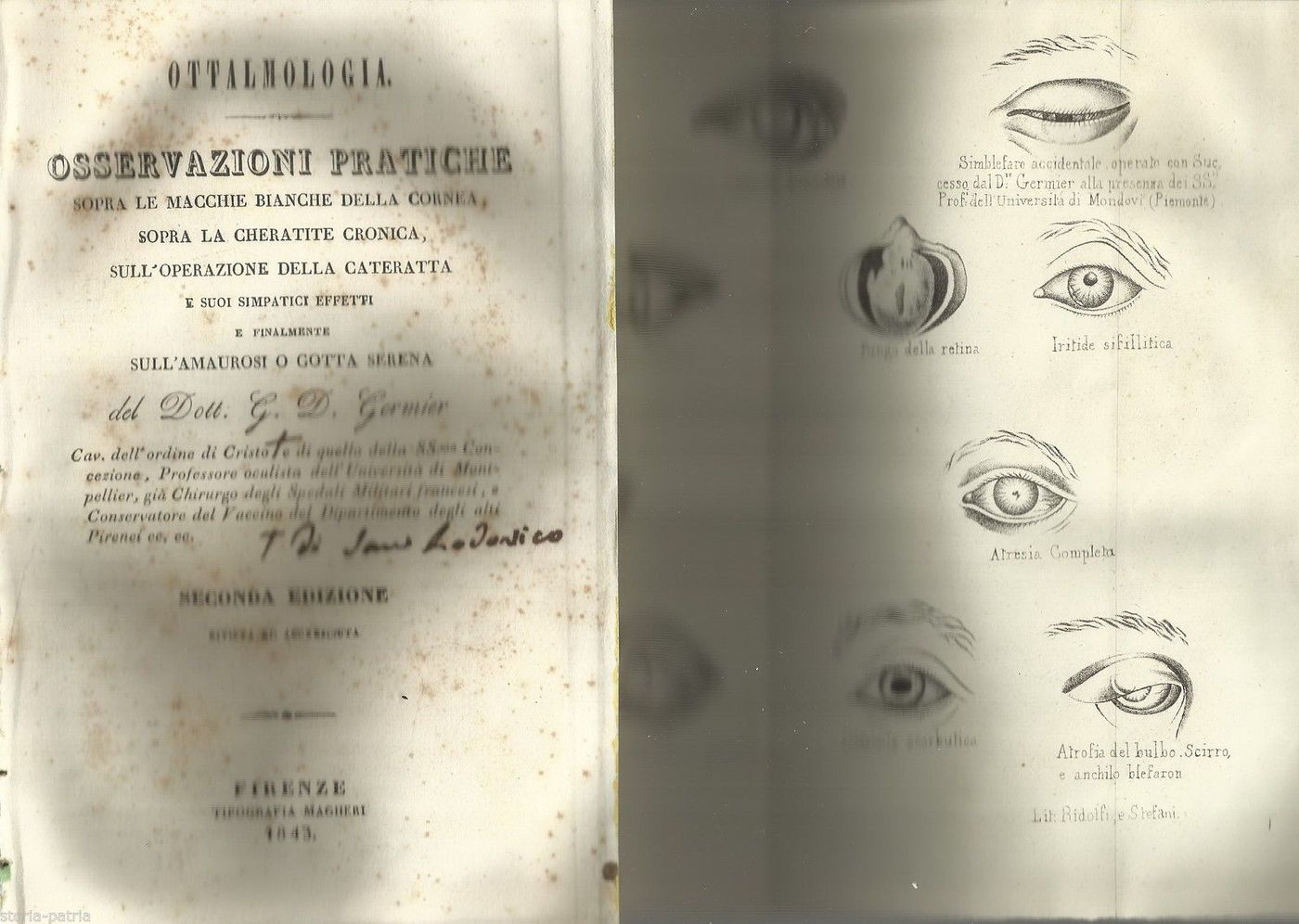 Ottalmologia: Osservazioni Pratiche Sulle Patologie Della Cornea E Cataratta