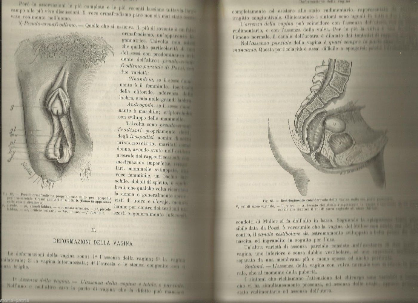 Trattato Di Chirurgia: Urologia E Ginecologia (Duplay, Reclus, 1896)