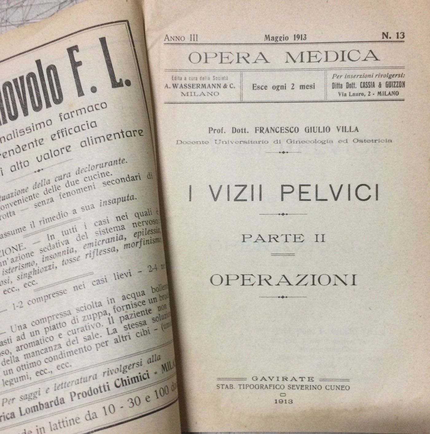I Vizii Pelvici: Parte II Operazioni   Francesco Giulio Villa (1913)
