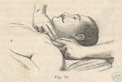 Lezioni Di Medicina Operatoria, Padula E Pasanisi, Napoli, 1908