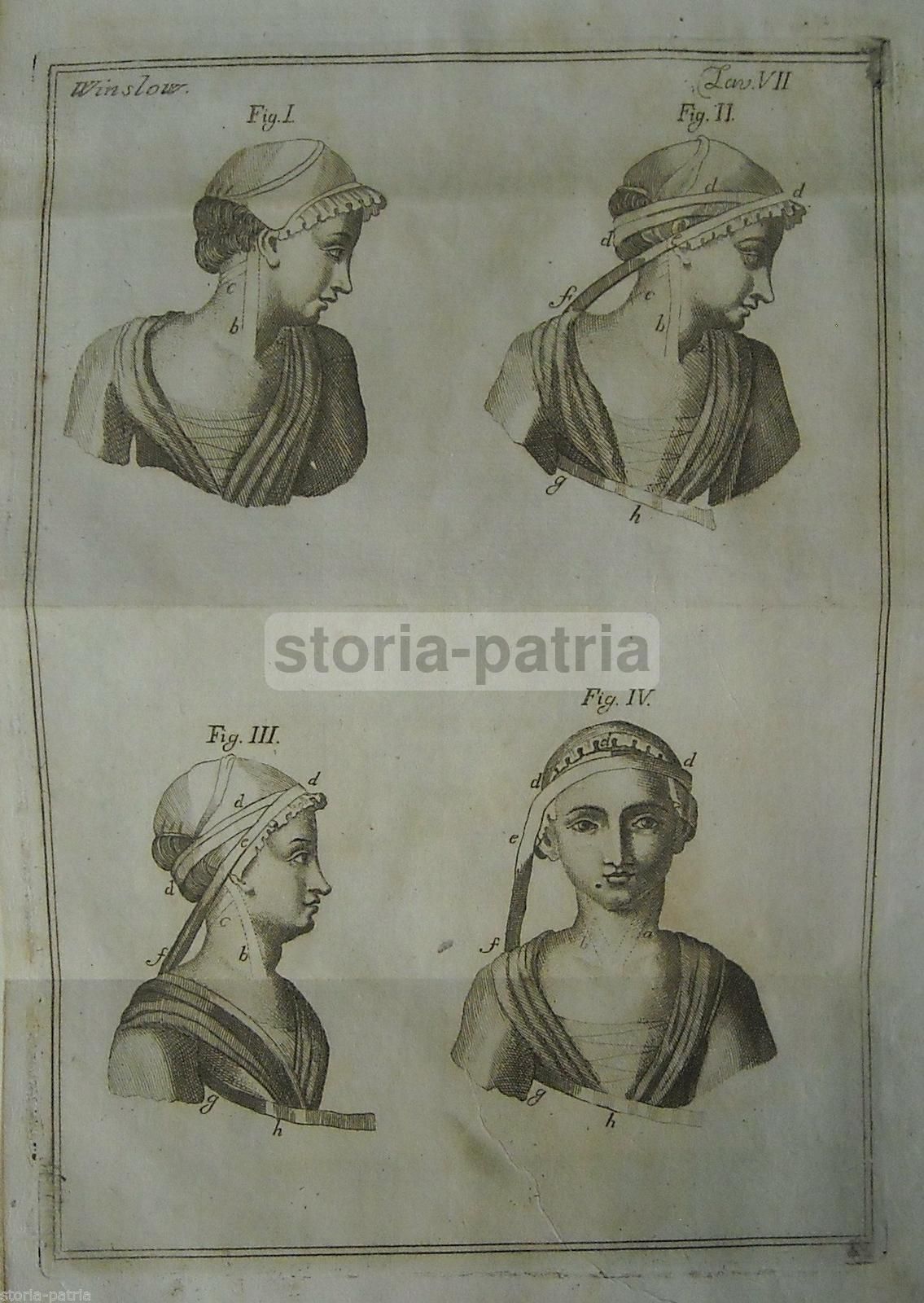 Incisione Antica: Bendaggio Della Testa, Medicina E Chirurgia, 1770 Circa