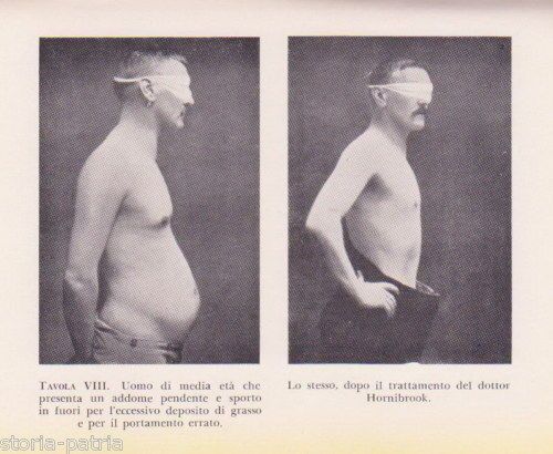 Hornibrook   La Cura Estetica Dell'Addome   Longanesi 1954