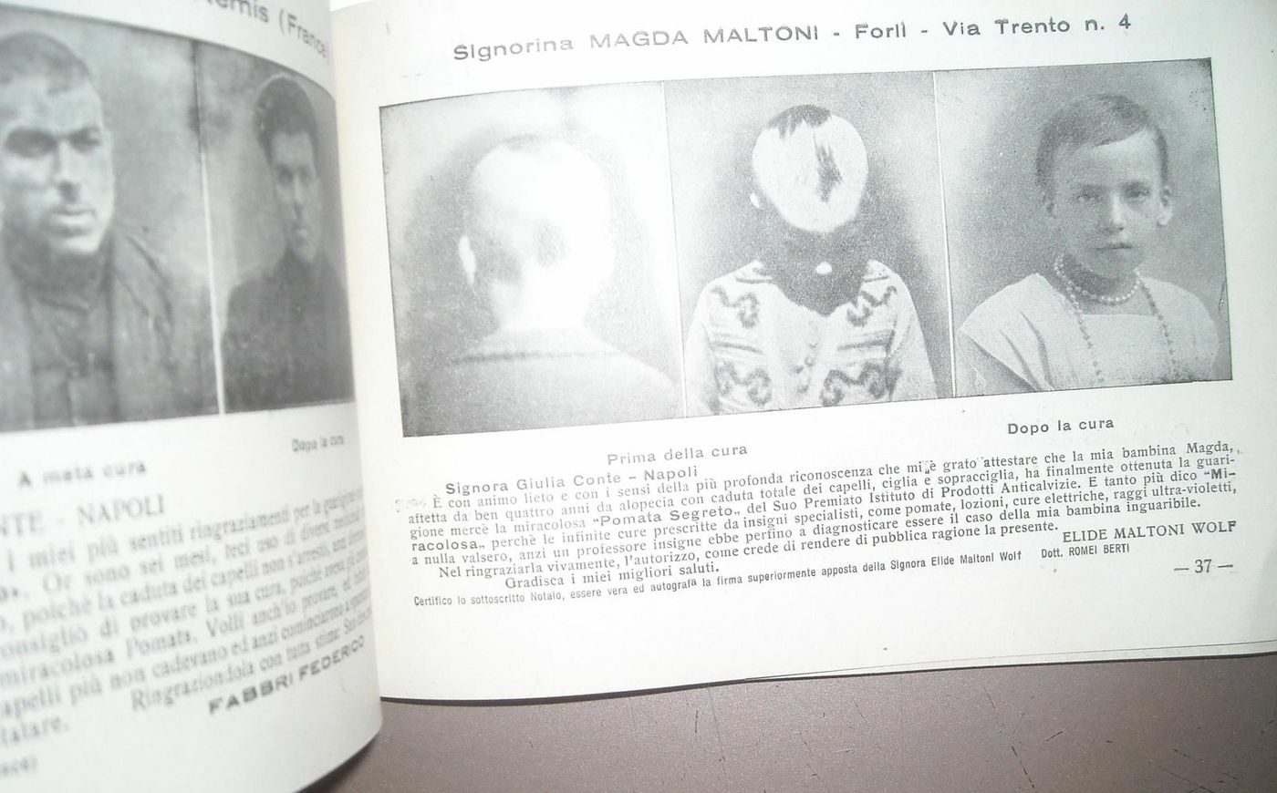 Pubblicazione Anticalvizie Giulia Conte Napoli 1939 Farmacia Epoca
