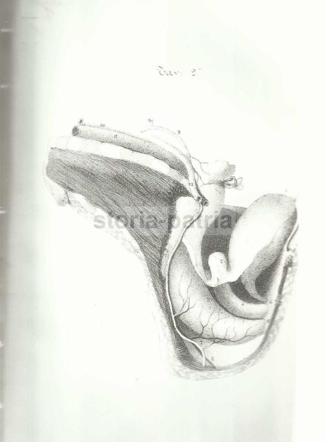 Medicina Ginecologia Chirurgia 1847 Napoli Giuseppe Sorrentino