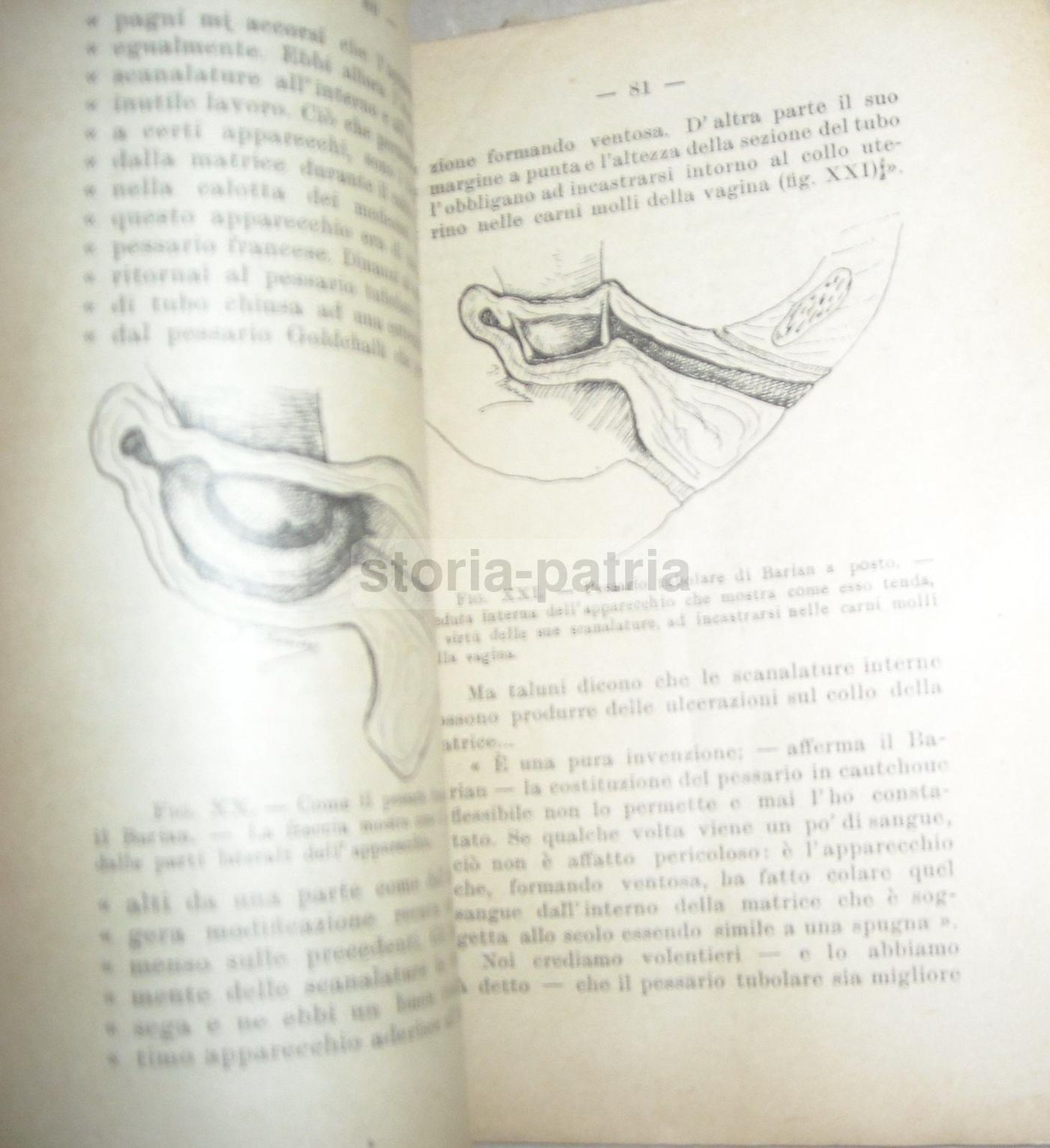 L'Arte Di Non Far Figli Di Secondo Giorni (1912). Trattato Di Neo Malthusianismo E Anticoncezionali