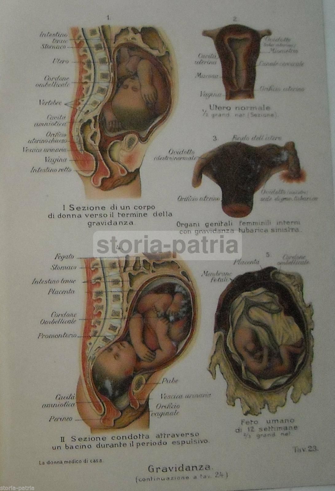 Stampa Anatomica Gravidanza E Feto, Cromolitografia 1920