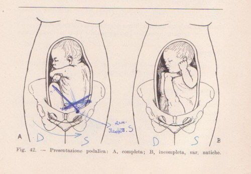 Manuale Pratico Di Ostetricia E Ginecologia   Mario Nizza (1956)