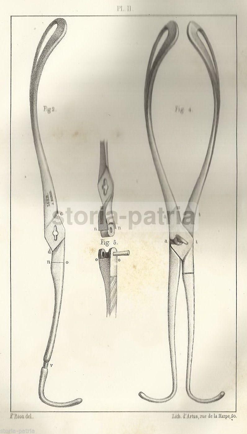 Forcipe Tarsitani 1844: Trattato Di Ostetricia, Parigi, Duca Di Serracapriola