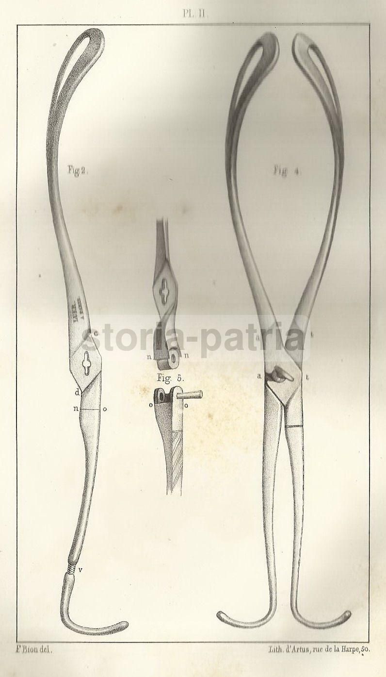 Forcipe Tarsitani 1844: Trattato Di Ostetricia, Parigi, Duca Di Serracapriola