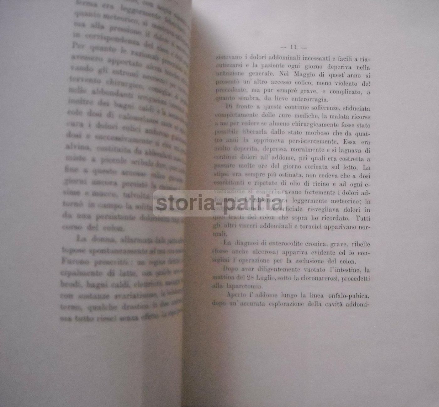 Nannotti, Enterocolite Cronica E Chirurgia Del Colon, Pistoia 1900